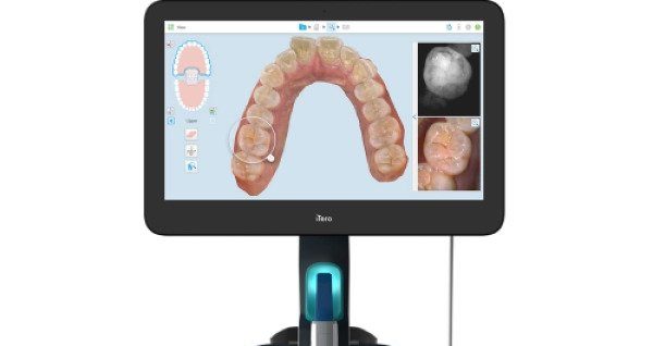 Advanced dental technology showing oral structures